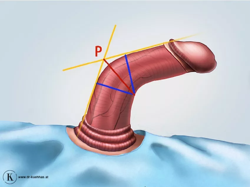 stage-t-schritt_01.jpg